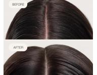 Bezoplachov� sprej na hydrat�ciu a upokojenie poko�ky hlavy Goldwell Dualsenses Scalp Specialist Rebalance & Hydrate Fluid - 150