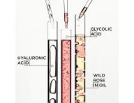 Rad pre hydratciu a rozjasnenie dlhch vlasov so sklonom ku krepovateniu Krastase Gloss Absolu