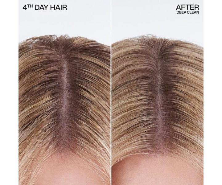 H�bkovo �istiaci such� �amp�n Redken Deep Clean Dry Shampoo - 155 ml