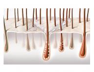 Rad pre problematick pokoku hlavy a vlasy Goldwell Dualsenses Scalp Specialist