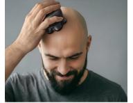 Rota�n� holiaci stroj�ek na vlasy Sencor Head Shaver SMS 0800BK - �ierny