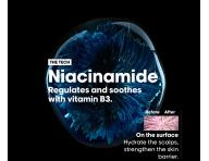 Rad na upokojenie vlasovej pokoky Loral Professionnel Scalp Advanced Anti-Discomfort