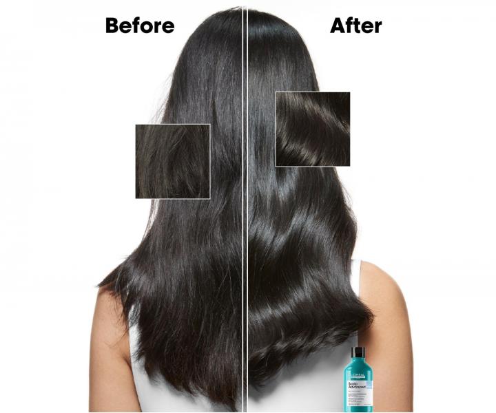 istiaci ampn proti lupinm Loral Professionnel Scalp Advanced Anti-Dandruff - 500 ml