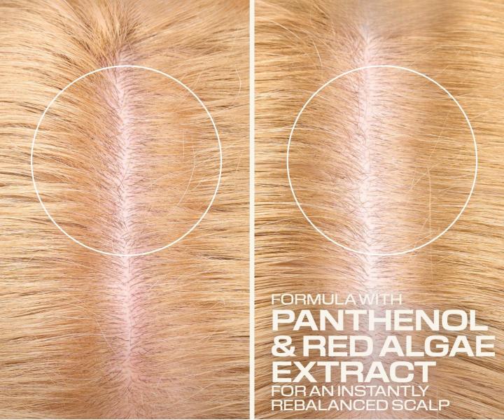 Bezoplachov� sprej na hydrat�ciu a upokojenie poko�ky hlavy Goldwell Dualsenses Scalp Specialist Rebalance & Hydrate Fluid - 150