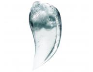 Rad na upokojenie vlasovej pokoky Loral Professionnel Scalp Advanced Anti-Discomfort