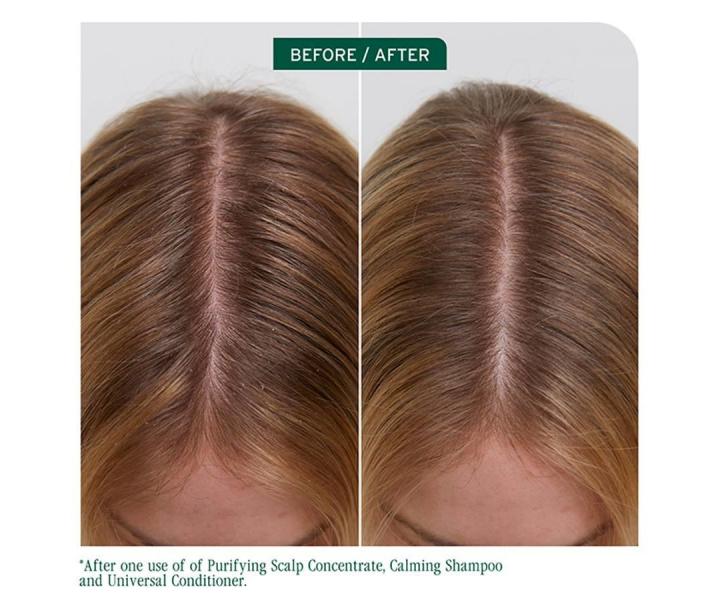 Pr�pravn� �istiaca starostlivos� pre v�etky typy vlasovej poko�ky Biolage Scalp Sync Purifying Scalp Concentrate - 200 ml