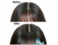 Starostlivos o vlasov pokoku Loral Professionnel Scalp Advanced