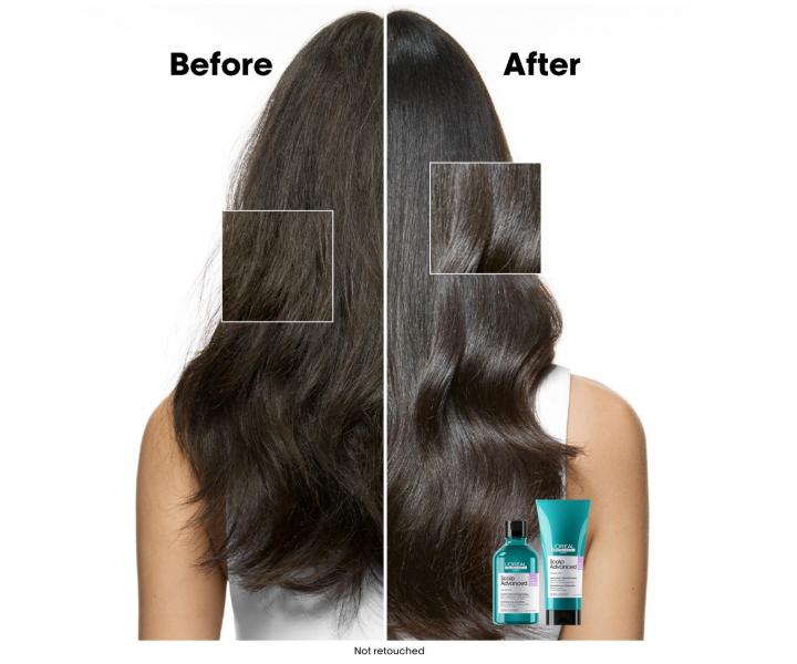 Rad na upokojenie vlasovej pokoky Loral Professionnel Scalp Advanced Anti-Discomfort