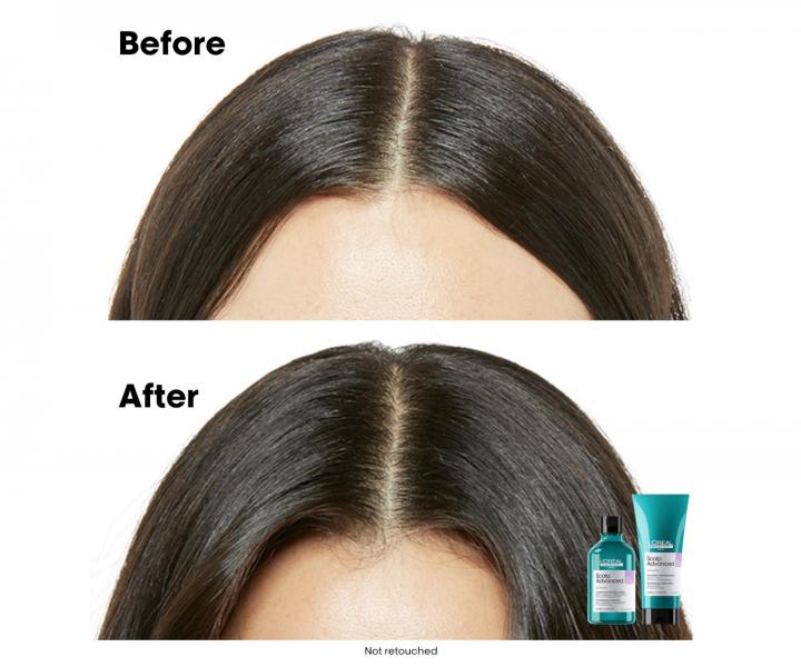 Rad na upokojenie vlasovej pokoky Loral Professionnel Scalp Advanced Anti-Discomfort