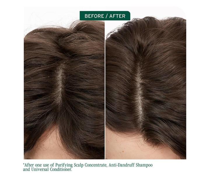 Rad pre zdravie pokoky hlavy Matrix Biolage ScalpSync