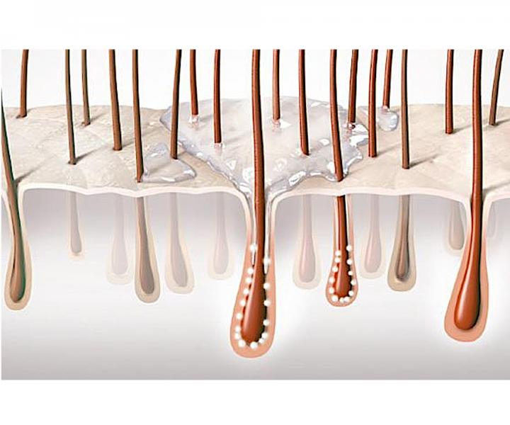 Rad pre problematick pokoku hlavy a vlasy Goldwell Dualsenses Scalp Specialist