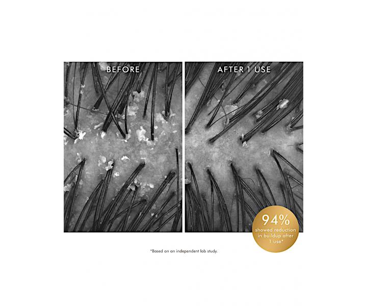 Predampnov istiaci peeling pre zdrav pokoku hlavy Moroccanoil Scalp Purifying Scrub - 125 ml