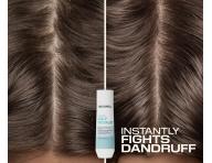 �amp�n proti lupin�m Goldwell Dualsenses Scalp Specialist Anti-Dandruff Shampoo - 250 ml