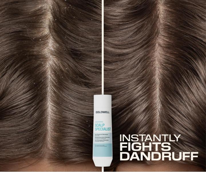 �amp�n proti lupin�m Goldwell Dualsenses Scalp Specialist Anti-Dandruff Shampoo - 250 ml