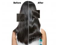 istiaci ampn proti lupinm Loral Professionnel Scalp Advanced Anti-Dandruff - 500 ml