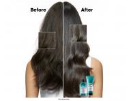 Rad na upokojenie vlasovej pokoky Loral Professionnel Scalp Advanced Anti-Discomfort