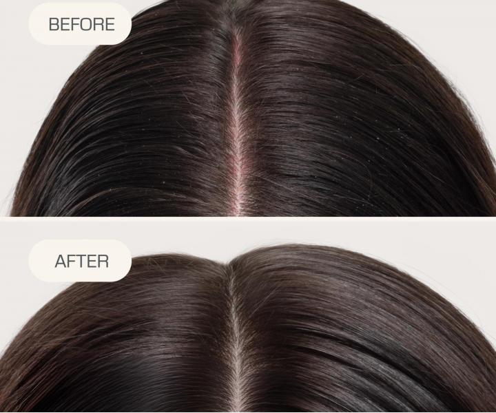 Bezoplachov� sprej na hydrat�ciu a upokojenie poko�ky hlavy Goldwell Dualsenses Scalp Specialist Rebalance & Hydrate Fluid - 150