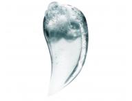 ampn pre mastiacu sa vlasov pokoku Loral Professionnel Scalp Advanced Anti-Oiliness - 1500 ml